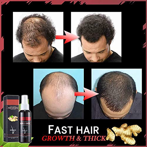 100 ml Saç Artı Zencefil Sprey, Zencefil Saç Büyüme Sprey, Saç Dökülmesini Önlemek Besleyici Saç Köklerinin Geliştirmek Saç